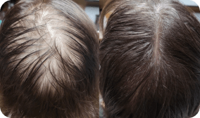 Kiierr Laser Cap reviews